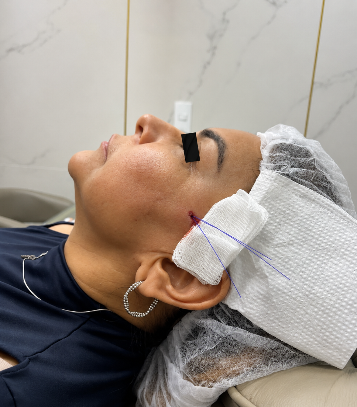 Estética Facial Adequa